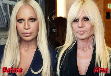 donatella versace 2019|donatella versace before and after.